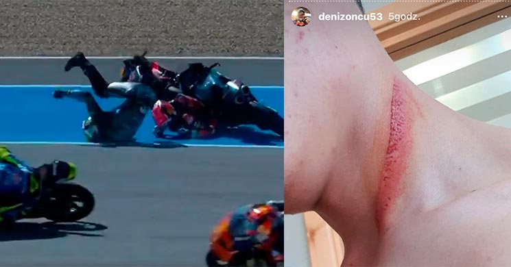 Kecelakaan Tikungan Akhir Moto3 Jerez, Leher Oncu Tersayat Cakram – NontonMotoGP 6 Kecelakaan Tikungan Akhir Moto3 Jerez, Oncu Beruntung Leher Tak Putus