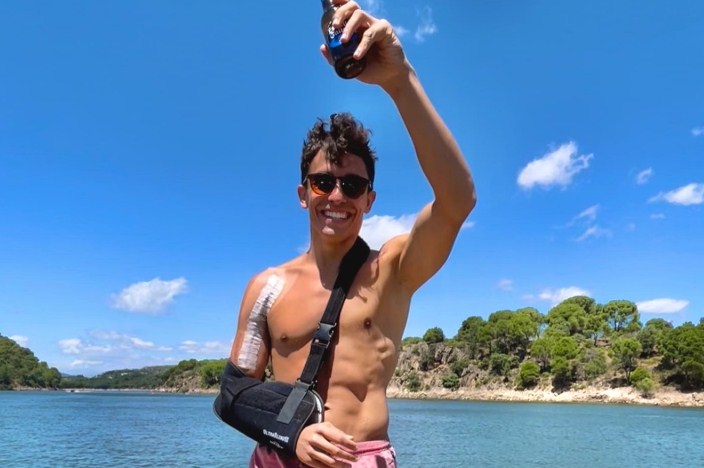 Kondisi Terkini Marquez, Tangan Belum Bisa Digerakkan, Tetap Ingin Balapan – NontonMotoGP 6 Kondisi Terkini Marquez, Tangan Belum Bisa Digerakkan, Tetap Ingin Balapan